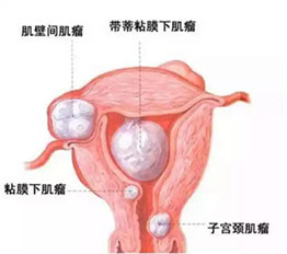 深圳收債公司